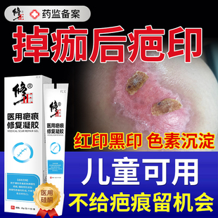掉痂后去红印黑印疤印伤疤修复膏擦伤摔伤祛疤膏去除黑色素沉淀HT