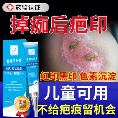 祛疤印黑印擦伤疤痕修复膏儿童