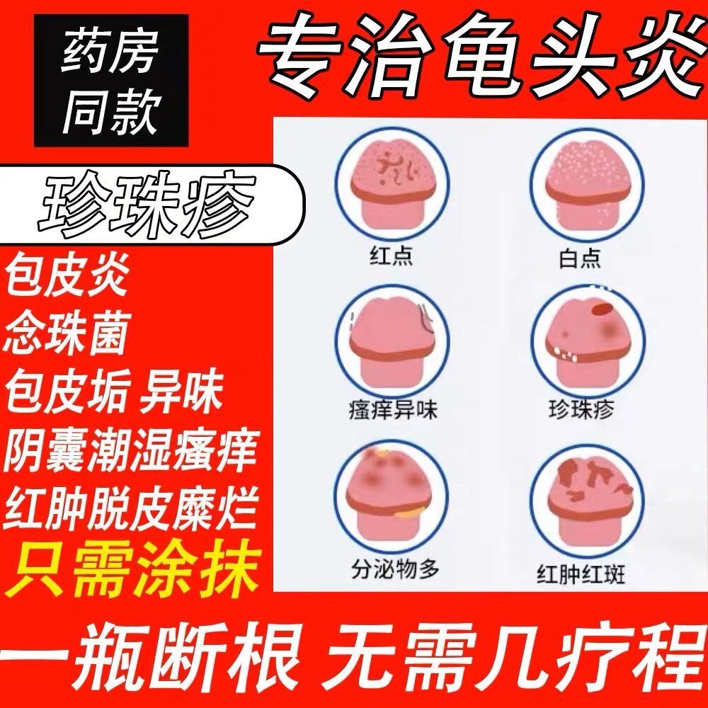 男性阴囊潮湿瘙痒湿疹止痒膏私处睾丸下体男士大腿内侧根真菌去藓