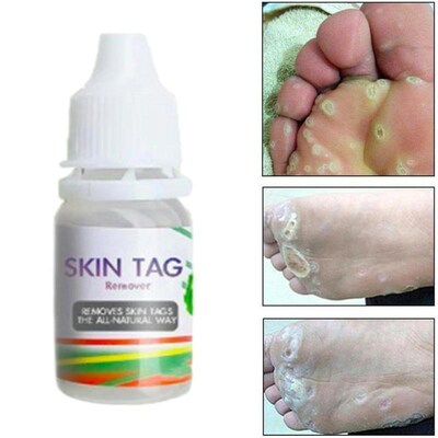 2pcs Plantar Genital Warts Ointment Skin Tag Remover Cream
