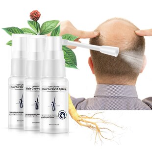 Hair Growth Spray Anti Hair Loss Serum for Hair Growth