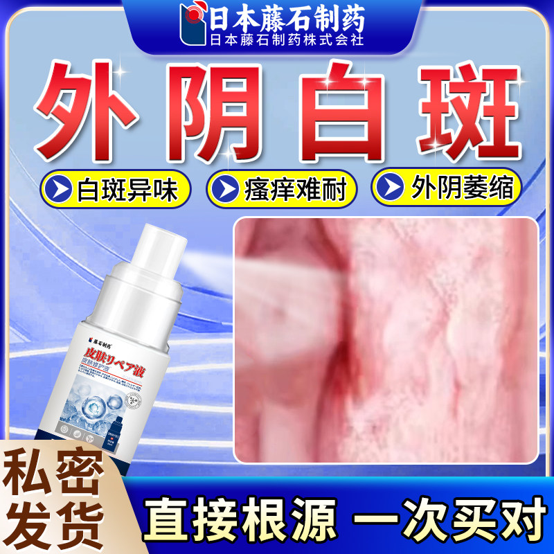 外阴白斑专用消白止痒软膏药外阴奇白消萎缩女私处抑菌去痒正品az