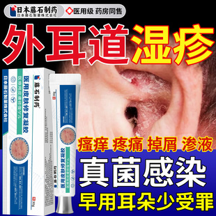 外耳道炎湿疹耳朵痒真菌感染瘙痒渗液疼痛掉屑脱皮止痒可搭药膏EH