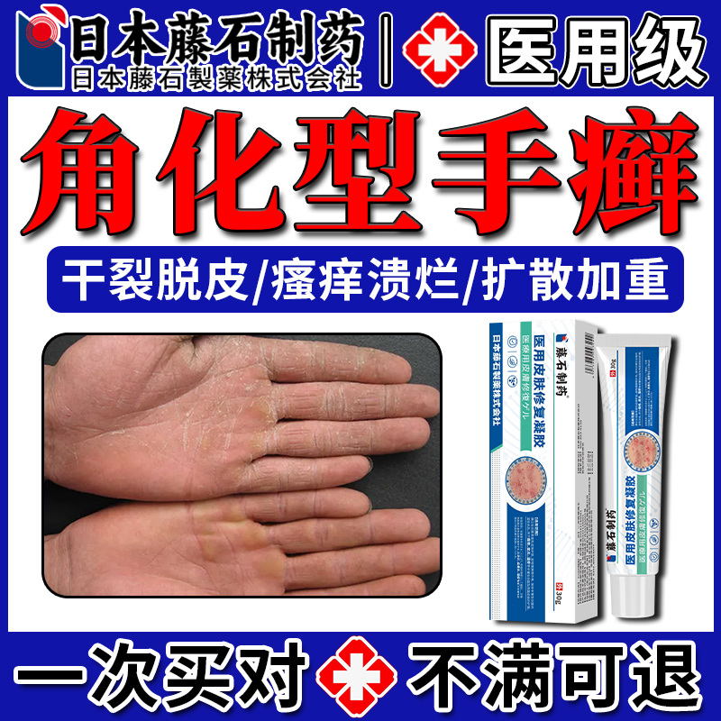 【日本藤石】角化型手癣专用膏