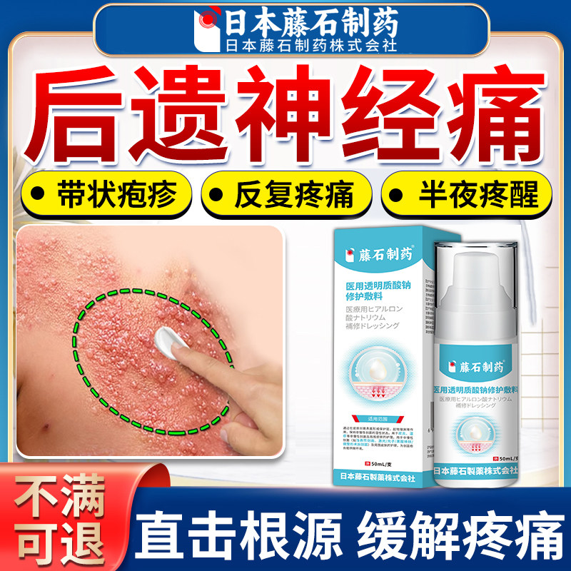 带状疱疹后遗症神经痛特外用效缓解神经痛蛇缠腰疱疹可搭膏药贴AZ