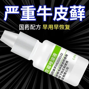 皮肤病癣药水老牌子白云山克霉唑溶液喷雾剂甲沟炎牛皮癣 手足癣