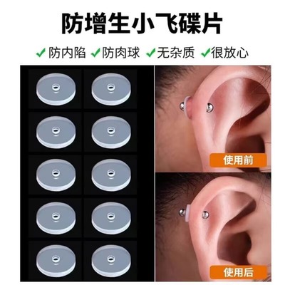 防增生小飞碟各类型全尺寸