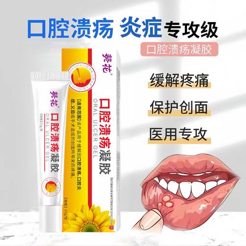 口腔溃疡发炎牙齿特疼起泡上火