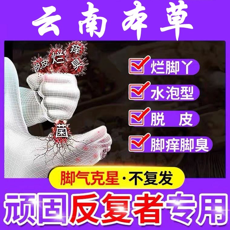 脚臭云南黄金百草旗舰店去脚气喷剂止痒药膏脱皮细菌杀菌水雾根部
