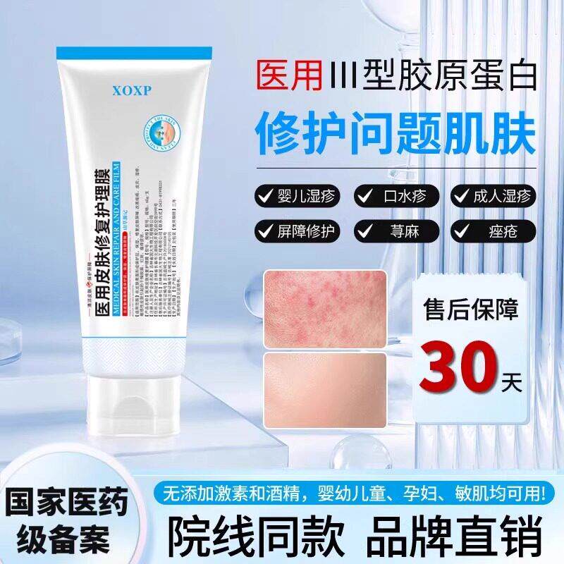 ddt护理膜O溢脂性皮炎痤