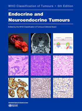 现货 英文原版 内分泌和神经内分泌肿瘤Endocrine and Neuroendocrine Tumours: WHO Classification of Tum 9789283245247