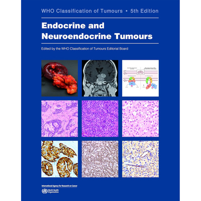 WHO内分泌和神经内分泌肿瘤