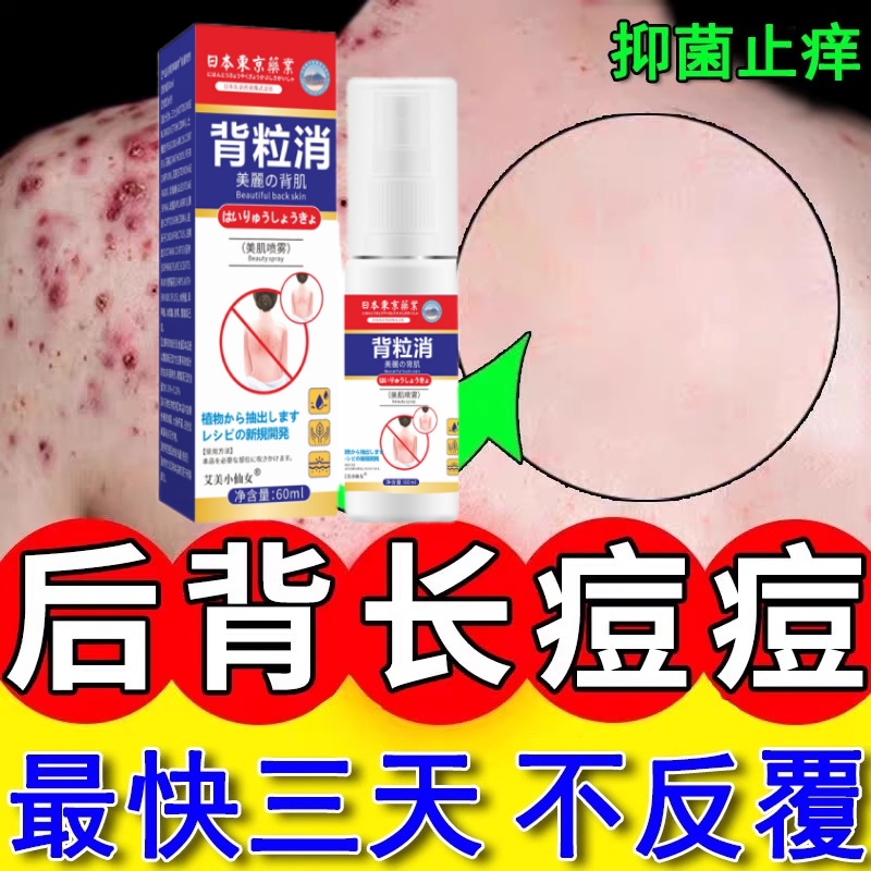 【日本祛痘神器】后背痘痘前胸除螨粉刺痘坑背立消喷雾毛囊炎正品