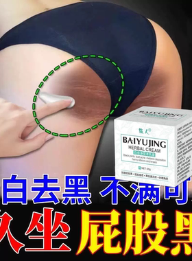 屁股蛋去黑坐印去除臀部私处美白药膏大腿内侧发黑色素沉淀黑棘皮