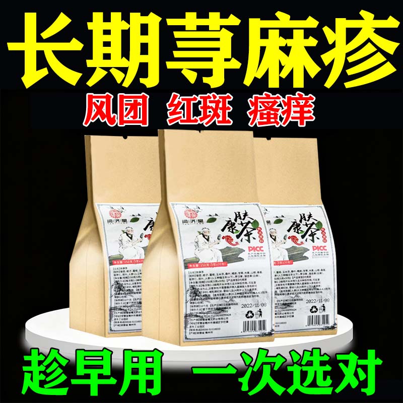 荨麻疹中草药荨麻疹泡澡茶包荨麻疹中草药调理非提高免疫力