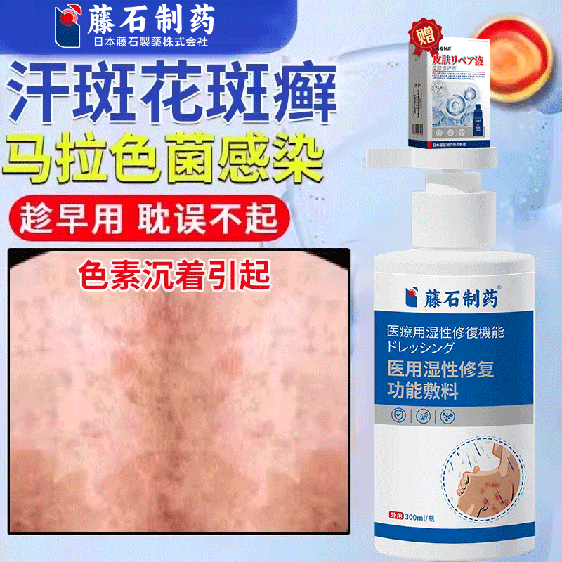汗斑沐浴露汗斑花斑癣专用js