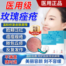 玫瑰痤疮屏障修复痤疮消炎面膜去青春痘粉刺闭口祛痘印涂膜剂js