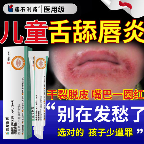 儿童舌舔唇炎专用唇膏药房同售