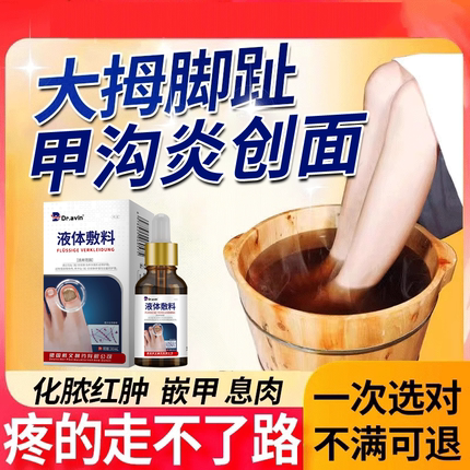甲沟炎泡脚包矫正器专用药房同售膏软化剂指甲刀医用红肿化脓js
