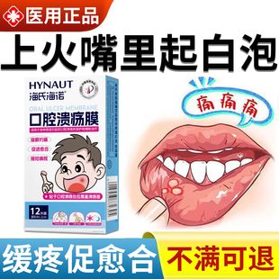口腔溃疡嘴里起泡口舌溃烂反复专用膜口腔白点疼痛抑菌修复黏膜SK