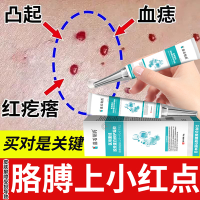 手臂胳膊长小红点血管瘤药房同膏血管痣蜘蛛痣去除专藤石制药膏js