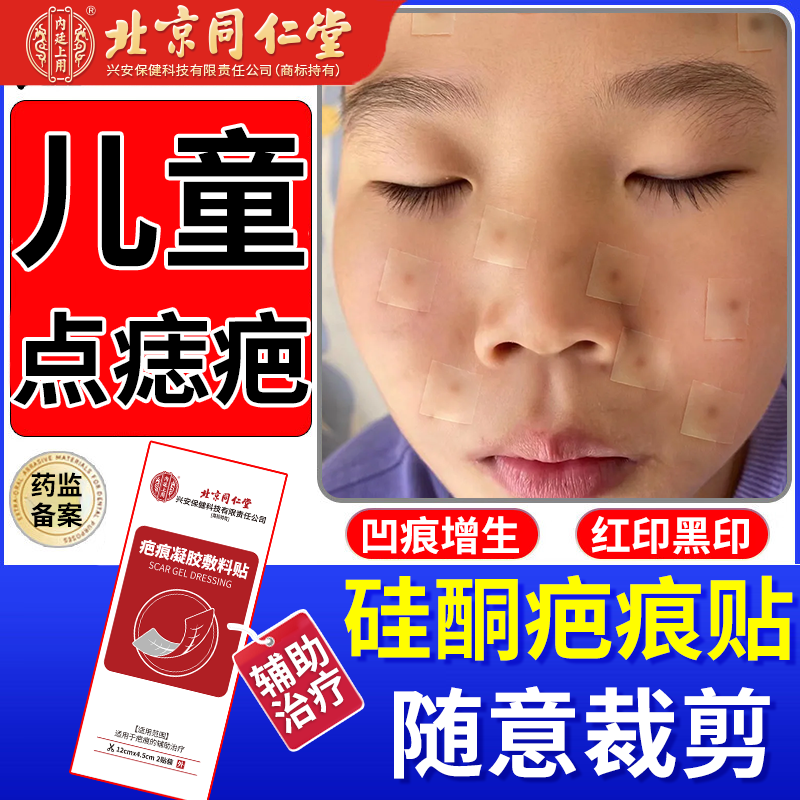 儿童点痣后修复膏疤痕贴红印去黑印色素沉淀消红印凸起疙瘩硬肉PG