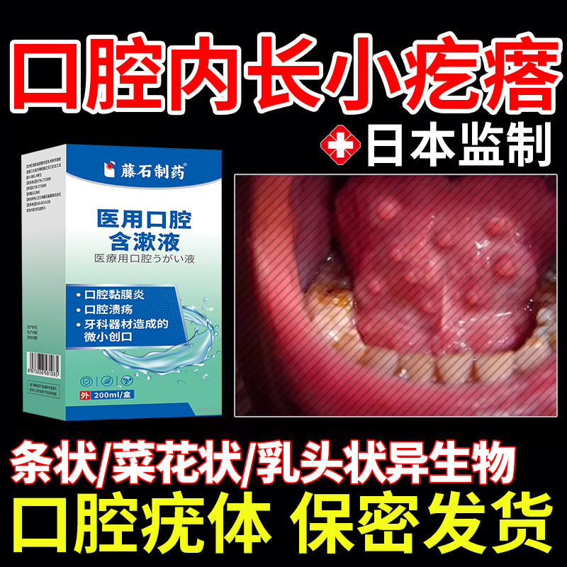药房同售口腔尖锐湿疣男女性hpv检测肉疙瘩干扰素嘴里膏喷雾剂JA