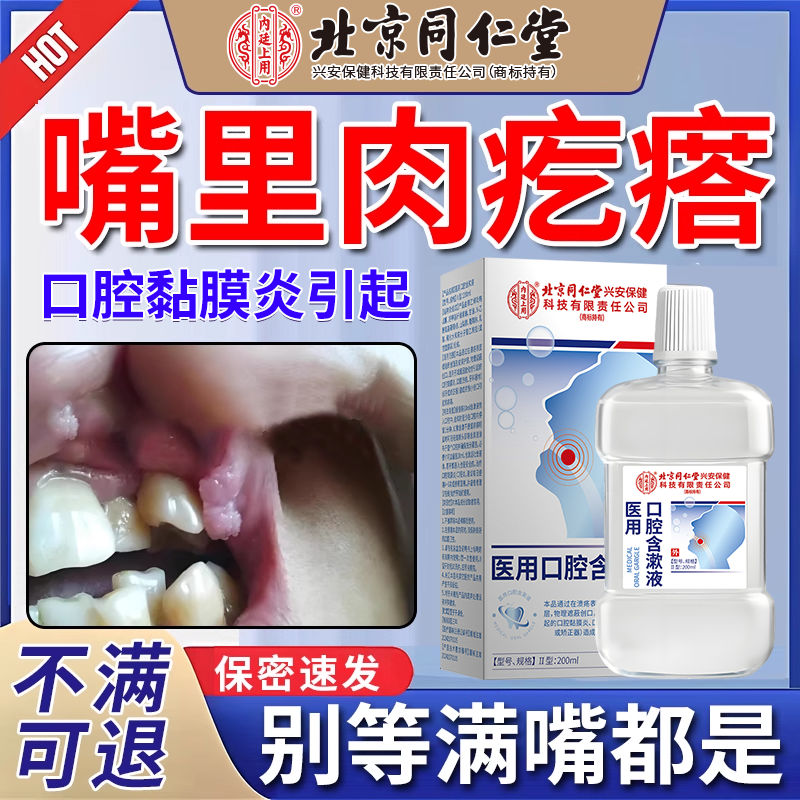 嘴里长肉疙瘩口腔尖锐湿疣专外用喷雾药制霉菌素漱水hpv抗病毒js