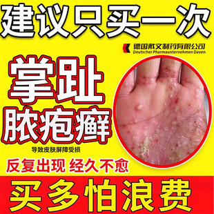 掌趾脓疱病掌跖脓包角化病症QK专用手脚脓包角化脱皮干裂