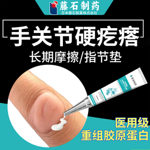 指节垫药房同售手指关节上长硬疙瘩膏老茧子癣增厚皮肤真菌感染QK