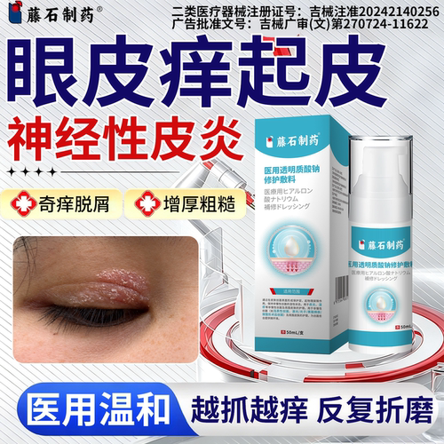眼皮神经性皮炎湿疹止痒膏