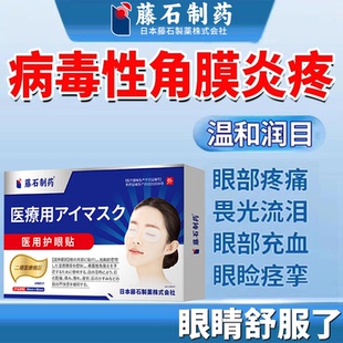 病毒性角膜炎滴眼液眼部疼痛畏光流泪眼睛充血肿胀眼睑痉挛眼部QK