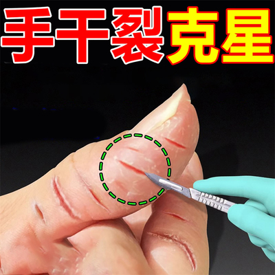 冶手裂口干裂修复霜手指头皲裂防裂膏脚后跟脱皮粗糙开裂专用软膏