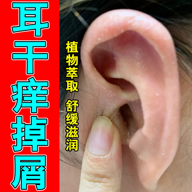 耳朵反复发痒脱皮干屑耳内结痂舒缓修护草本萃取膏
