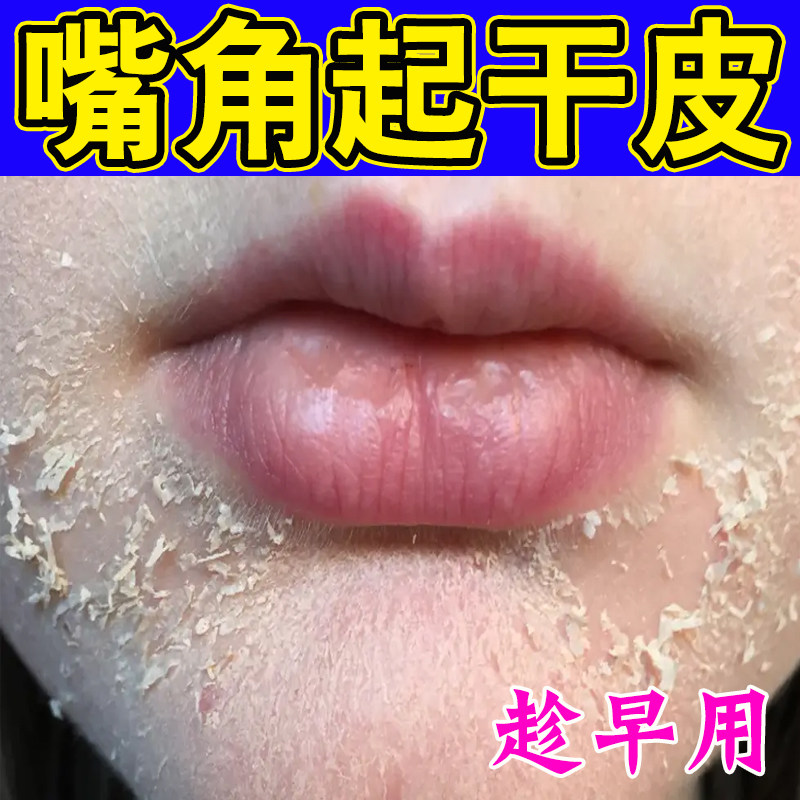 脸上干燥起皮滋润皮肤修复脸部红有碎屑补水男女士脸脱皮面霜