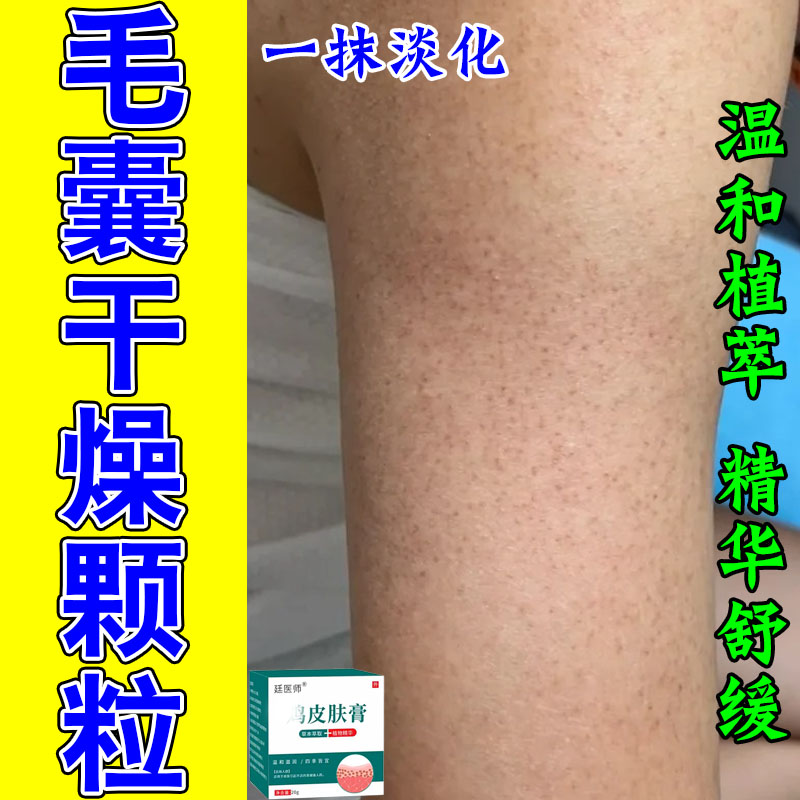 胳膊上起红点疙瘩粗糙手臂毛囊起痘鸡皮肤毛囊角化质修护霜