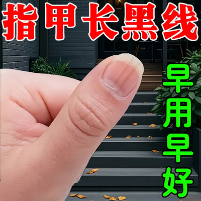 去除指甲上长黑线指甲黑色竖甲母痣淤血空指甲分层黄厚凹陷修复药