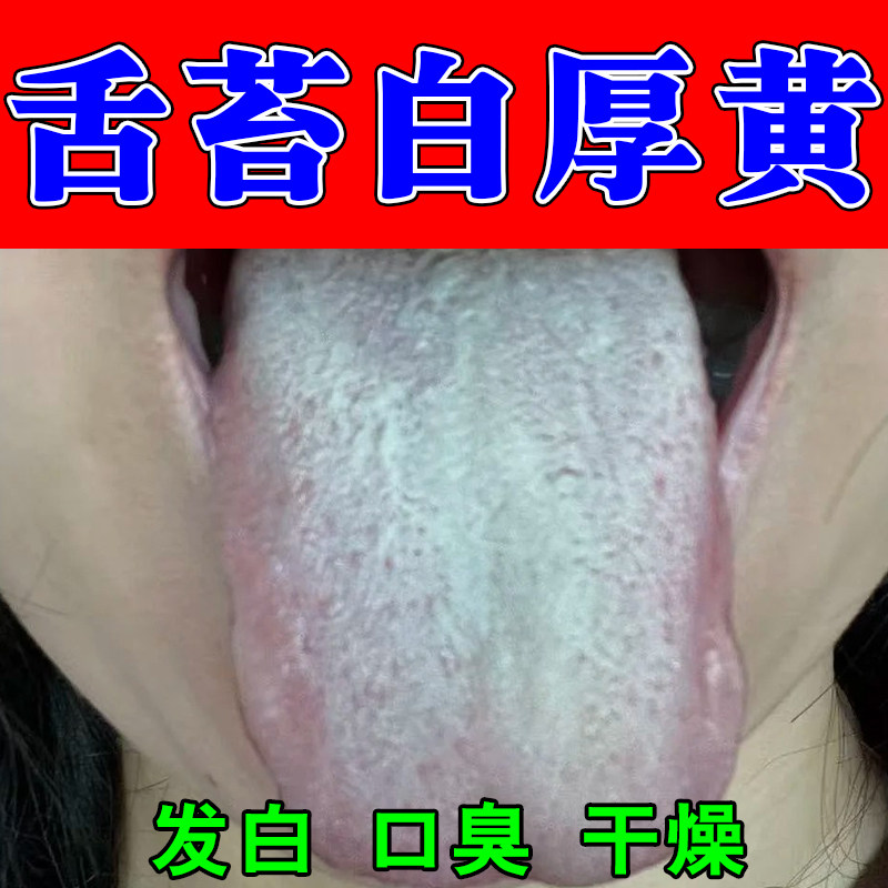 舌苔白厚口臭舌头黄厚腻口臭湿气重舌头发白干植物温和修护喷剂