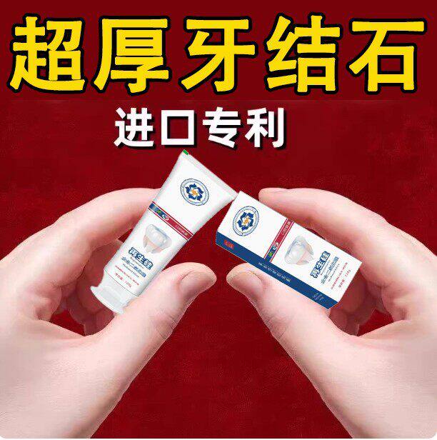 不用去洗牙【刷白了】牙石牙垢嘴巴臭亮白去牙石去渍烟渍牙膏