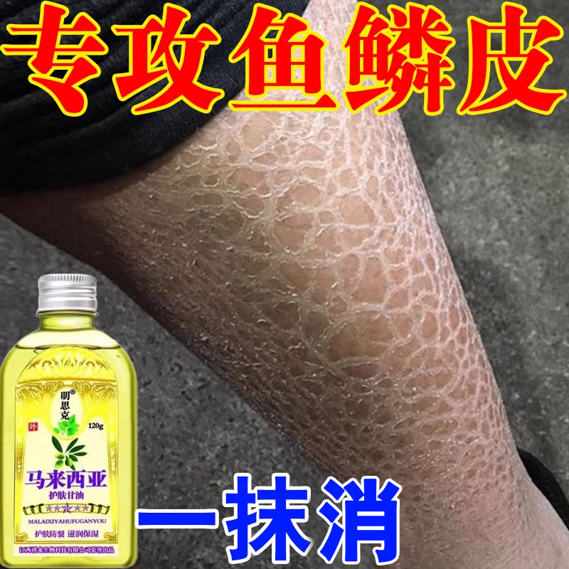 老人学生皮肤干燥掉皮屑痒脱皮专用修复霜