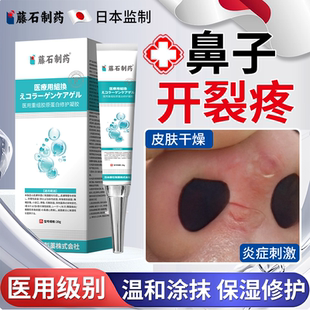 冬天鼻口鼻子开裂鼻孔干裂裂口鼻翼烂鼻子下面两侧裂开药房款膏OZ