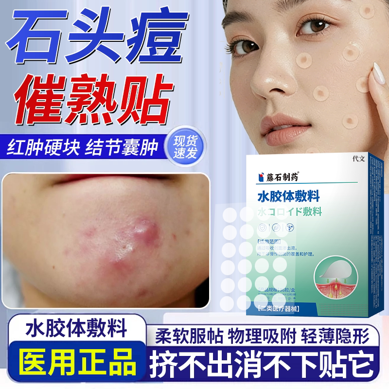 祛石头痘红肿硬块医用痘痘贴下巴反复长痘催熟修复消炎痘印吸脓QF