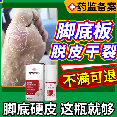 正品保障】脚底板脱皮干裂起硬皮
