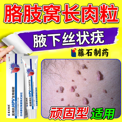正品保障腋下丝状疣去小肉粒买它