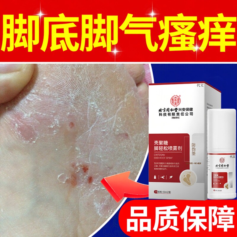 脚底痒用什么药脚底板真菌感染脚部湿疹脚气水泡可搭药膏脚心痒OZ