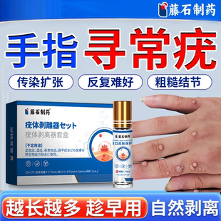 手指寻常疣贴甲周疣手上长硬疙瘩去除神器专用膏根祛疣药房同售QF