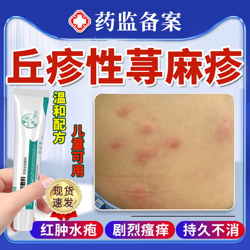 丘疹性荨麻疹虫咬性皮炎增强免疫力专用可搭香皂肥皂药房同款膏JW