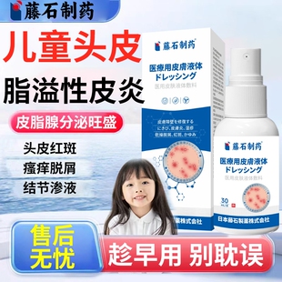儿童头皮脂溢性皮炎毛囊炎洗发水去屑止痒抑菌真菌感染头癣喷剂EM