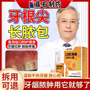 牙根尖牙龈脓包肿痛肿胀鼓包消炎专牙根发炎用止痛喷剂药监备案EM