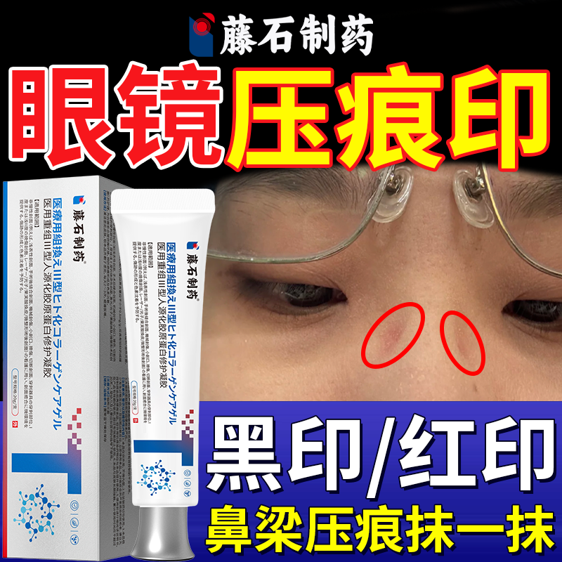 眼镜压痕眼镜印消除去除黑红印鼻梁压痕修复可搭防压贴防压神器OZ